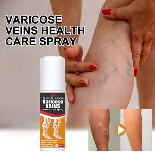 Image of Fresh & Young Varicose Veins Spray | Natural Formula for Fast Relief | Reduces Swelling, Relieves Pain & Improves Blood Circulation | Easy-to-Use Spray for Legs & Feet - 50 ml