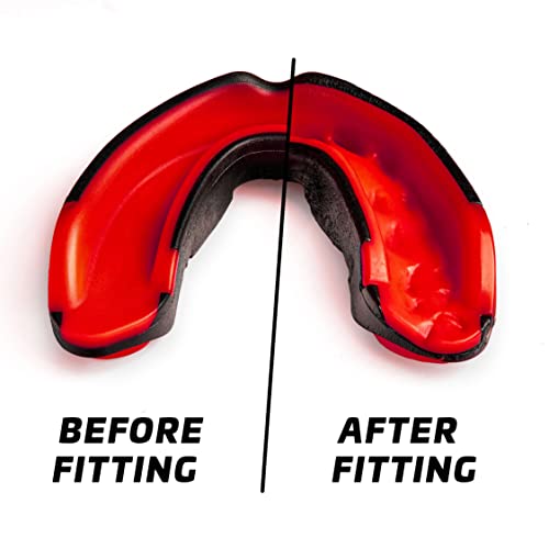 Legenda Mouth Guard Sports W/Case, Professional Mouthguard For Boxing, Football, Hockey, Jiu Jitsu, Muay Thai, Mma, Wrestling And High Contact Sports, Fits Adults, Youth, Kids 11+ (Black/Red) #TOP1