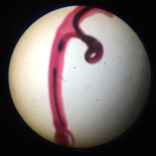 1 Pieces Parasitology Prepared Slides Sexual mosaic of Schistosoma japonicum W.M.