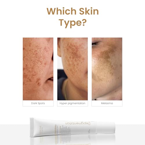Image of Personal Touch Melakey Radiance Cream for Hyperpigmentation & Melasma | Pigmentation Removal Cream | Pigmentation Cream for Men & Women | 5% Azelaic Acid | Dark Spot Corrector with Glycolic Acid & Niacinamide for Even Skin Tone | 40gm