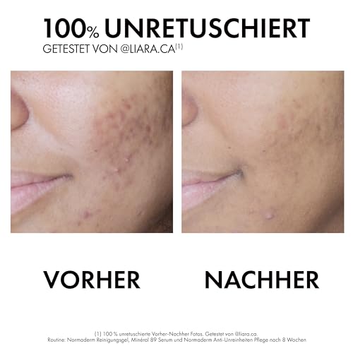 VICHY Sensitive Anti-Unreinheiten-Pflege, Für fettige, zu Akne neigende Haut, Mattierend und Regenerierend, Mit Hyaluron- und Salicylsäure, Normaderm Phytosolution, 50 ml