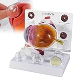 ROFALI Cataract Eye Model, Eye Anatomy Model, Enlarged Human Eyeball Model -with Explanatory Card, Human Eye Anatomical Model for Science Education, Students Study