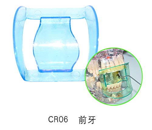 Sdent® Usa Fda & Tuv Ce 20Pcs Dental Mouth Prop Bite Block Cushion Opener Retractor Support Mouthpart Mouth Bites Block 10Pcs Anterior Teeth 10Pcs Posterior Teeth #TOP6