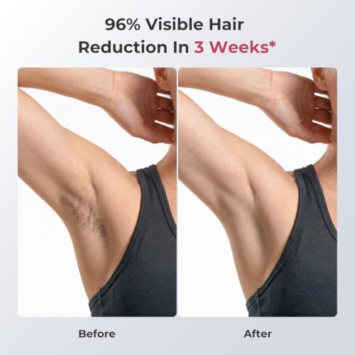 Ubroo IPL Laser Hair Removal Device, 21J Energy, 96% Hair Reduction, 41°F Ice Cooling for Women & Men, Face Bikini Underarm, Safe & Painless, At-Home Professional Results