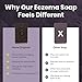 Marie Originals Eczema Face Soap Body Wash Bar – All Natural Psoriasis, Dermatitis Treatment for Dry Itchy Flaky Skin Relief – Gentle Detoxifying, Healing, Anti-Itch, Cleansing Skincare (Pack of 2)