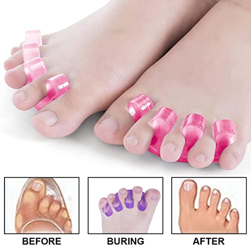 2-Pairs-Gel-Toe-Spacer-Toe-Stretch-Divider-Spacer-For-Men-And-Women-Toe-Relax-Pedicure-Bunion-Relief-Quick-Toe-Pain-Relief-After-Exercise