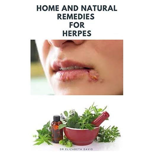 HOME AND NATURAL REMEDIES FOR HERPES