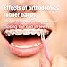 Orthodontic Elastic Rubber Bands,500 pcs (Medium, 3.5 Oz,3/16,Rabbit), Teckolign Orthodontic Elastic Rubber Bands, 500 Pack,Great for Dreadlocks, Braids, Tooth Gap, Braids, Dog Bows, Top knots, 5 Pack, with Elastic Placer for Braces.Good Orthodontic Supplies for oral care