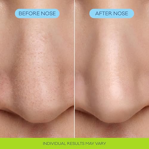 Image of Biore Pore Refining Bubbling Nose Mask, Glycolic Acid Exfoliant, 8 Count (Pack of 12)