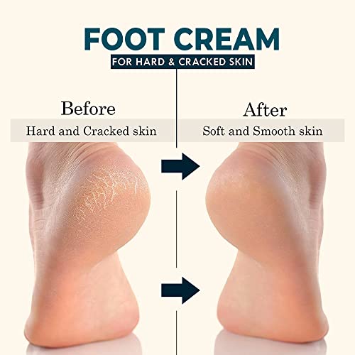 Image of ARTESIAN Artesian Heal Care Cream For Heel Repair, Ayurvedic Foot care cream With Benefits Of Aloe Vera - 50 Gram