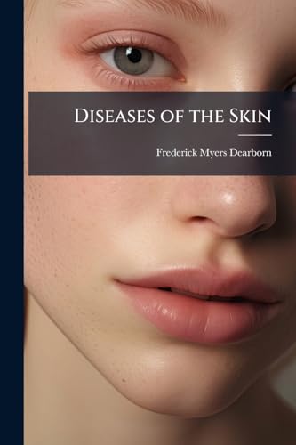 Diseases of the Skin: Including the Exanthemata, for the Use of General Practitioners and Advanced Students