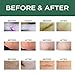 Scar Removal Cream Advanced Treatment for Old & New Scars from Cuts Stretch Marks, C-Sections & Surgeries With Natural Herbal Extracts Formula