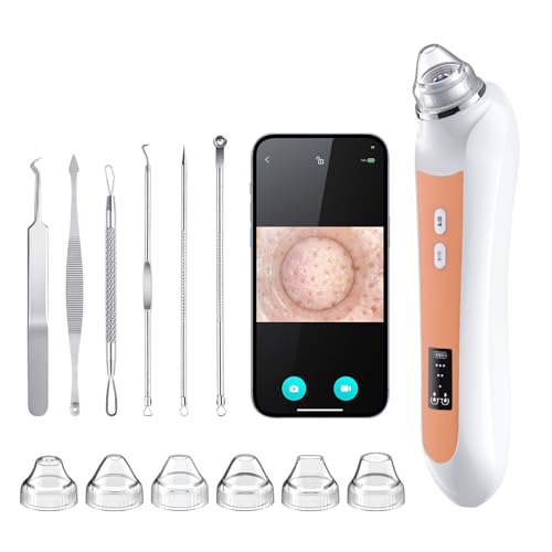 Image of Facial Pore Blackhead Remover Vacuum