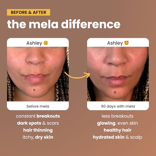 Mela Daily Glow Multivitamin