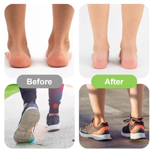 Image of Arch Support Compression Sleeves, 3 Pairs Cushioned Foot Relief Orthotic Insole for Plantar Fasciitis and Fallen Arches Weak Flat Feet Heel Spurs