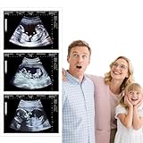 Generisch Personalisierbares Fake Ultraschallbild – Lustiges Schwangerschaftsbild zum Anpassen, Scherzartikel für Paare, Partner oder Ehepartner
