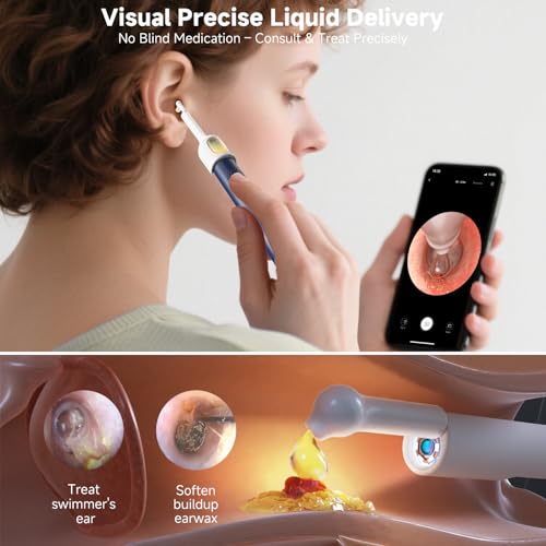 Image of BEBIRD R1 Ultra Ear Wax Remova, Ear Cleaner with Camera Ear Scope, Wax Remove Ear Pick with Ear Otoscope Tweezers, Visual Dropper Cleaning Kit, Ear /Nose /Throat Examination Tool for Family, Blue