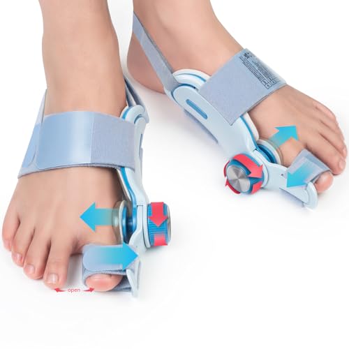 Tech Love Hallux Valgus Korrektur Fixierplatte Upgrade Doppelte Spannung Hallux Valgus Schiene Ballen Zehen Korrektor mit 3 Verschiedenen Befestigungswinkeln für Zehen Blau 2 Stück
