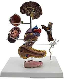 Anatomical Model of Human Diabetes 8 Pieces Model Teaching Medical Pathology Thrombosis Human Organs Pathology Modeluseful SaiFei