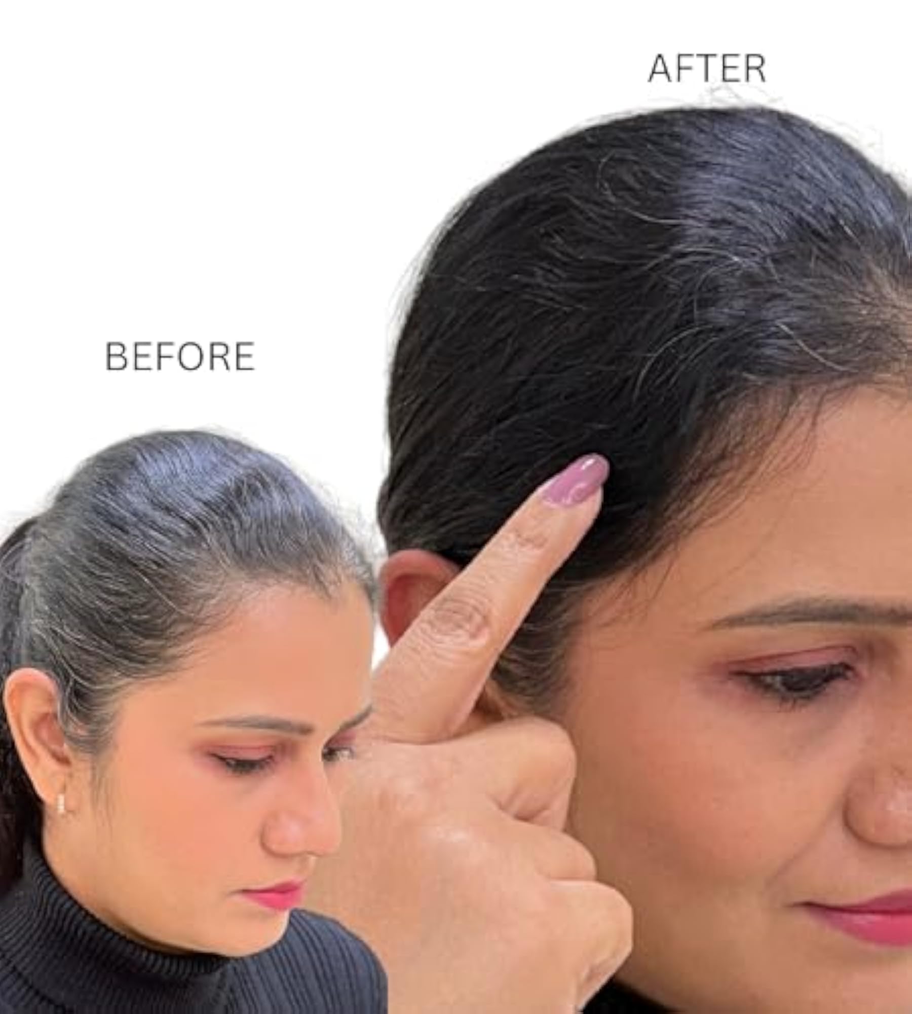 Invisible Cover Up Patch for Women, Front & Side Thinning