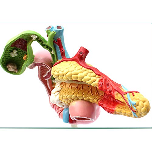 Modèle anatomique du pancréas pour expliquer les pathologies aux patients - 3