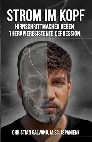 Strom im Kopf: Hirnschrittmacher gegen therapieresistente Depression
