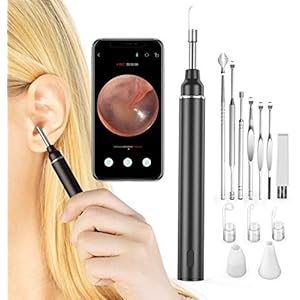 VITCOCO Otoscoop Oor Camera 5MP HD Oorsmeerverwijderingsset Oorreiniging 3 mm Visuele Oorscope voor iPhone en Android