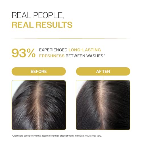Image of Bare Anatomy Oil Control Shampoo | Sulphate & Paraben Free | Reduces Excess Oil by Up to 100% | Salicylic Acid + Hyaluronic Acid + Tea Tree | Suitable for Oily Scalp & Dry Ends | For Women & Men | 236ml