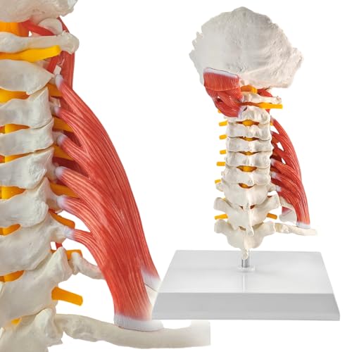 Image of EVOTECH SCIENTIFIC Cervical Spine Anatomical Model with Brainstem, Muscles, Thoracic Vertebrae & Nerves - Life-Size Human Neck Vertebrae Model for Medical Teaching, Chiropractic, and Anatomy Study
