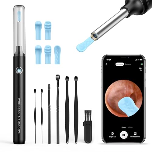 Ear Wax Removal Tool, Qimic Ear Cleaner Wax Removal, 1080P Ear Cleaner Camera with Anti-Dust Cover, Wireless Ear Camera Otoscope with Earwax Remover for iPhone, iPad & Android Smart Phones