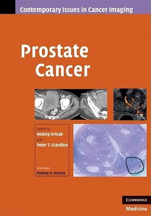 Prostate Cancer book cover