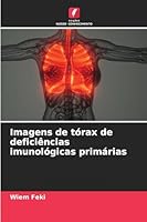 Imagens de tórax de deficiências imunológicas primárias 6209264557 Book Cover