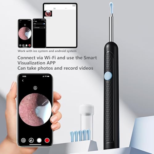 Image of Ear Cleaning Camera Wax Removal Tool kit, Flexible Ear Scope Otoscope Camera Light, Visual Ear Picker Wireless Earwax Remover Tweezers for Adults & Kid