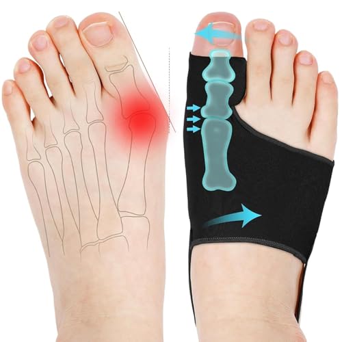 WELEQUT 2PCS Bunion Corrector for Women & Men - Toe Alignment Corrector with Splint & Pads for Hallux Valgus Pain Relief, Anti Slip Big Toe Straightener, Comfortable & Breathable for Day/Night(Black)