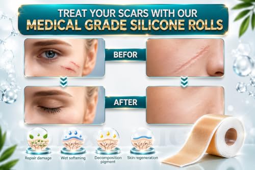 Image of QUIXOTIC Silicone Scar Sheets Tape Roll 1.5M | Reusable Silicone Strips for Scar Care | Surgical, C-Section, Tummy Tuck, Keloid & Acne Scars | Skin-Friendly (A1) (SKIN TONE)