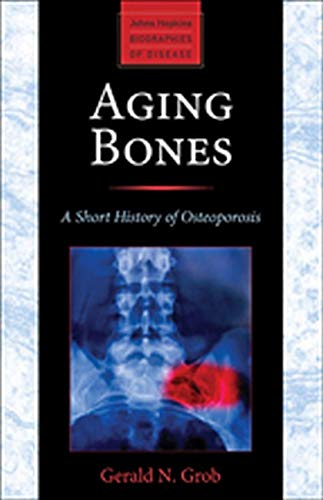Aging Bones: A Short History of Osteoporosis (Johns Hopkins Biographies of Disease) Aging Bones: A Short History of Osteoporosis (Johns Hopkins Biographies of Disease)