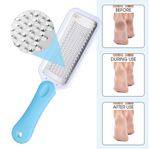 Foot File Feet Hard Skin Remover Foot Scraper Foot Files Foot Grater Foot exfoliator for Wet Dry Dead Rough Skin Dry Cracked Feet Foot Care - Image 4