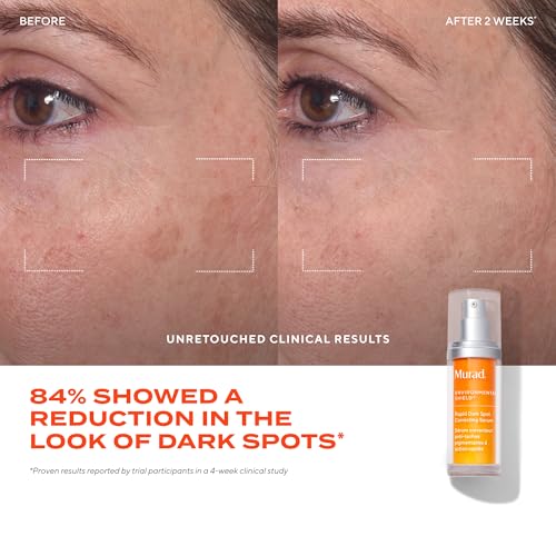 Thumbnail image for Murad Rapid Dark Spot Correcting Serum