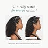 Nutrafol Women's Hair Growth Supplements, For Women 18-44 Years Old, Clinically Tested for Visibly Thicker, Stronger Hair, 100% Vegan Ingredients, Dermatologist Recomme - 3 Month Supply, 1.7 oz Bottle