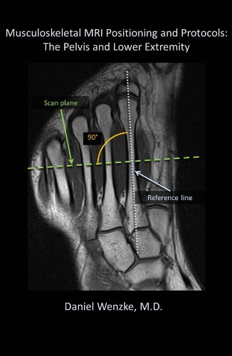 Musculoskeletal MRI Positioning and Protocols: The Pelvis and Lower Extremity