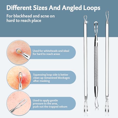 MENOLY Kit de ferramentas para remoção de cravos, 10 peças, removedor de cravos para manchas, extrat