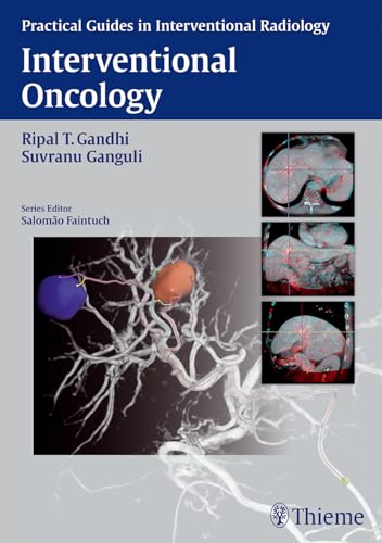 Interventional Oncology view 2