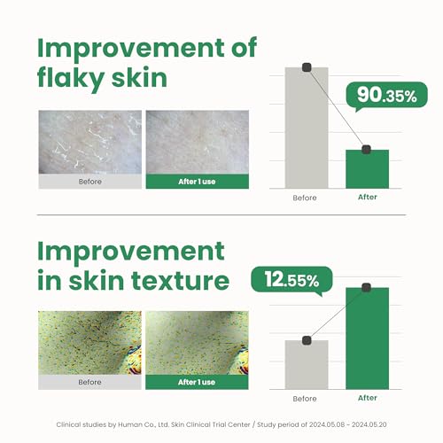 AXIS-Y PHA Resurfacing Glow Peel - 10% PHA Fruit Extract Mild Peeling Gel Exfoliator Pore Minimizer for Face - Vegan Korean Skin Care Glass Skin Face Peel - 1.69 fl. oz. - Image 6