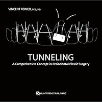 Tunneling: A Comprehensive Concept in Periodontal Plastic Surgery 1647241383 Book Cover
