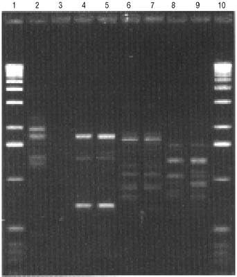 RPN8509 - illustra Nucleon HT - Nucleon HT Genomic DNA Extraction Kit, GE Healthcare - Each