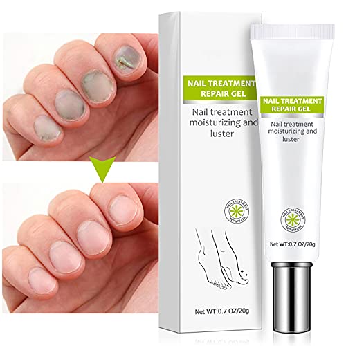 Toe Be Health Instant Beauty Gel, Nail Fungus Treatment for Toenail and Fingernail, Skin Healing Ointment for Cracked Heels and Dry Feet, Soothing Moisture Gel (2pcs)