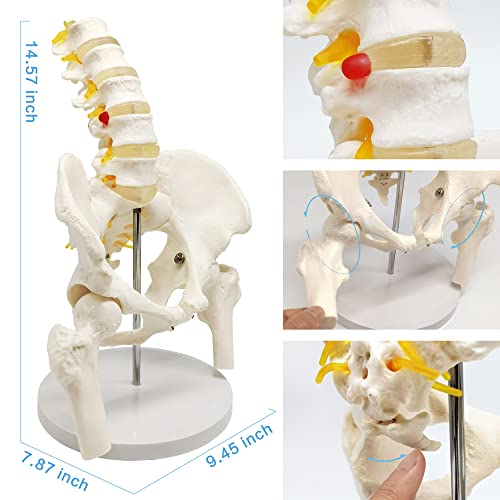 Image of EVOTECH SCIENTIFIC Male Pelvis Model with 5 Lumbar Spine, W /Removable Femur Head, Life Size Anatomy Medical Model for Science Education, Medical Demonstration Tool