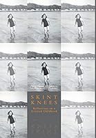 Skint Knees: Reflections on a Scottish Childhood 1460246357 Book Cover