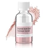 Drying Lotion for Acne, Anti Acne Face Serum Dry Out Blemishes & Pimple Reduce Redness, Overnight Acne Treatment Spot Treatment, Facial Lotion for Teenage Girl Women Men Skin Care, 29ml