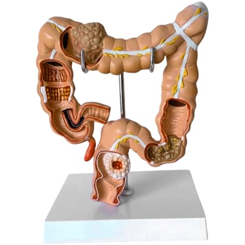 Modèle du système digestif pour illustrer vos consultations médicales - 2